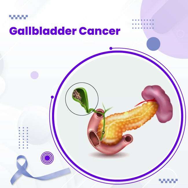 Gallbladder-Cancer