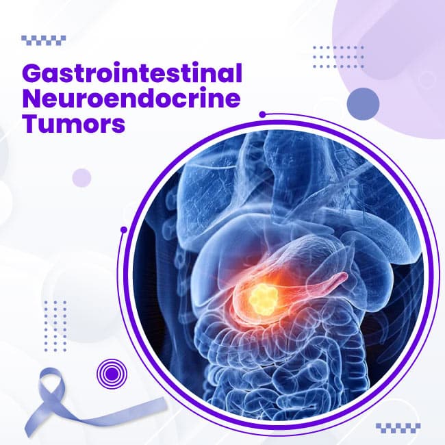 Gastrointestinal-Neuroendocrine-(Carcinoid)-Tumors