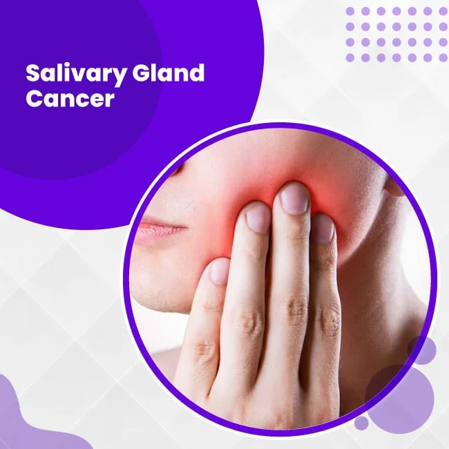 Salivary Gland Cancer, Signs and Symptoms| Uhapo