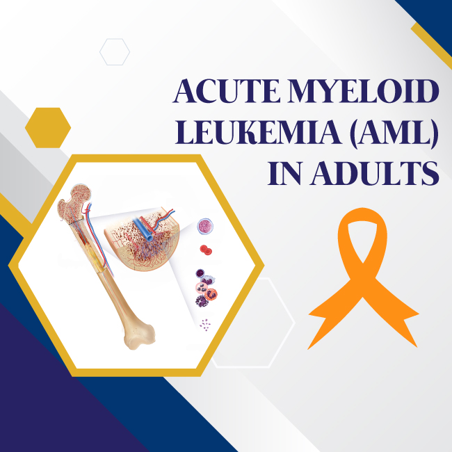 Acute Myeloid Leukemia (AML) in Adults