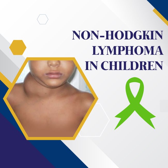 Non-Hodgkin Lymphoma in Children