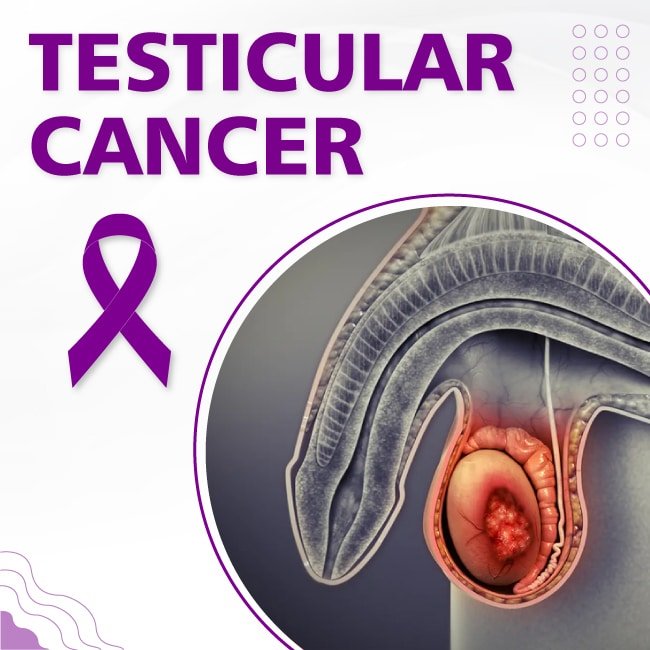 Testitucular Cancer Scrotal Cancer