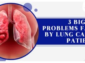 3 Biggest problems Faced by Lung Cancer patients?
